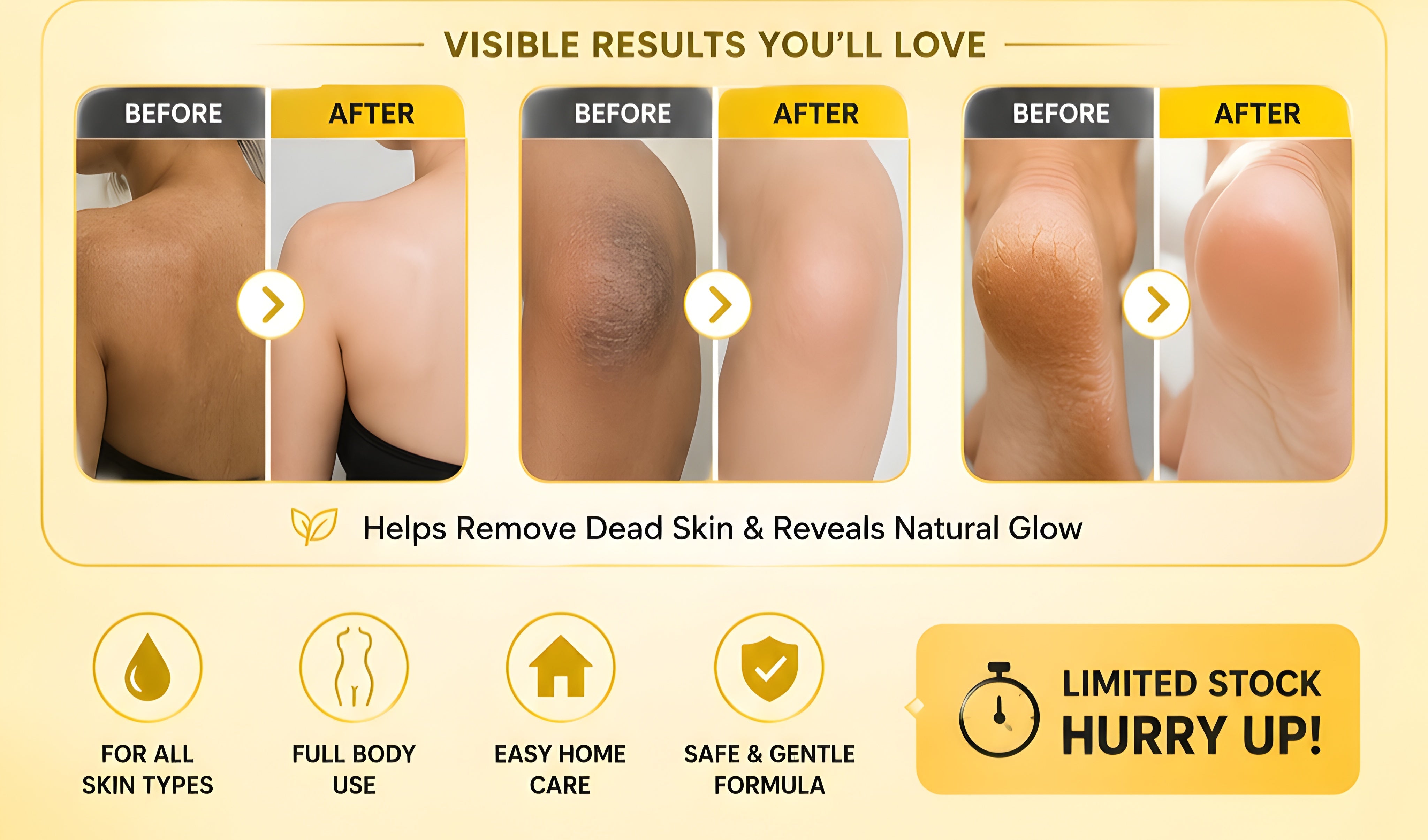 GlowRenew™ Yellow Peeling Oil – Remove Dead Skin & Reveal Smoother Skin (Pack of 2)